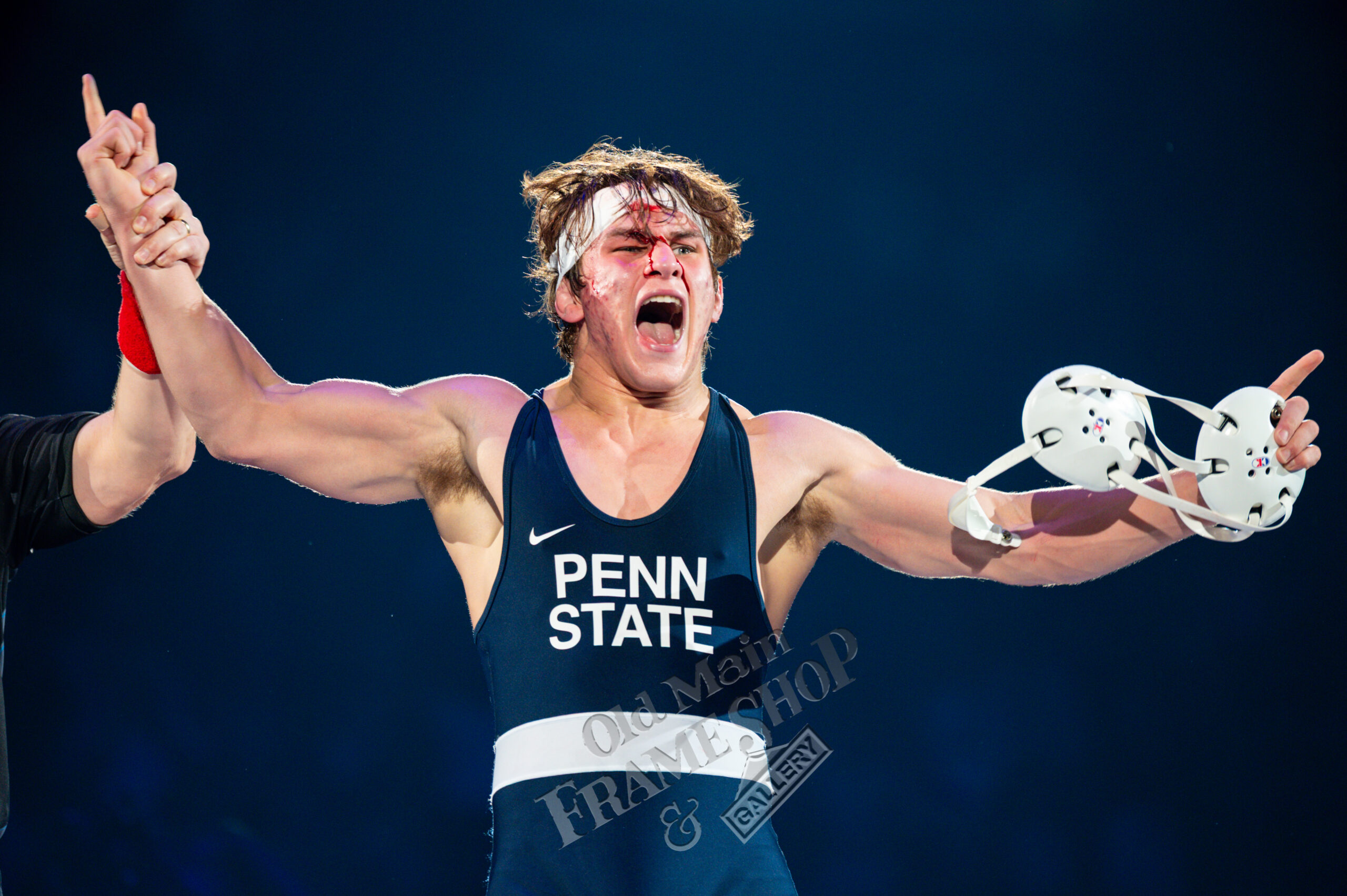Tyler Kasak victory shout with arms spread and forehead bleeding